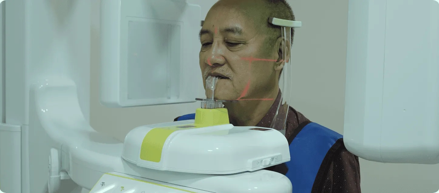Treatment-5