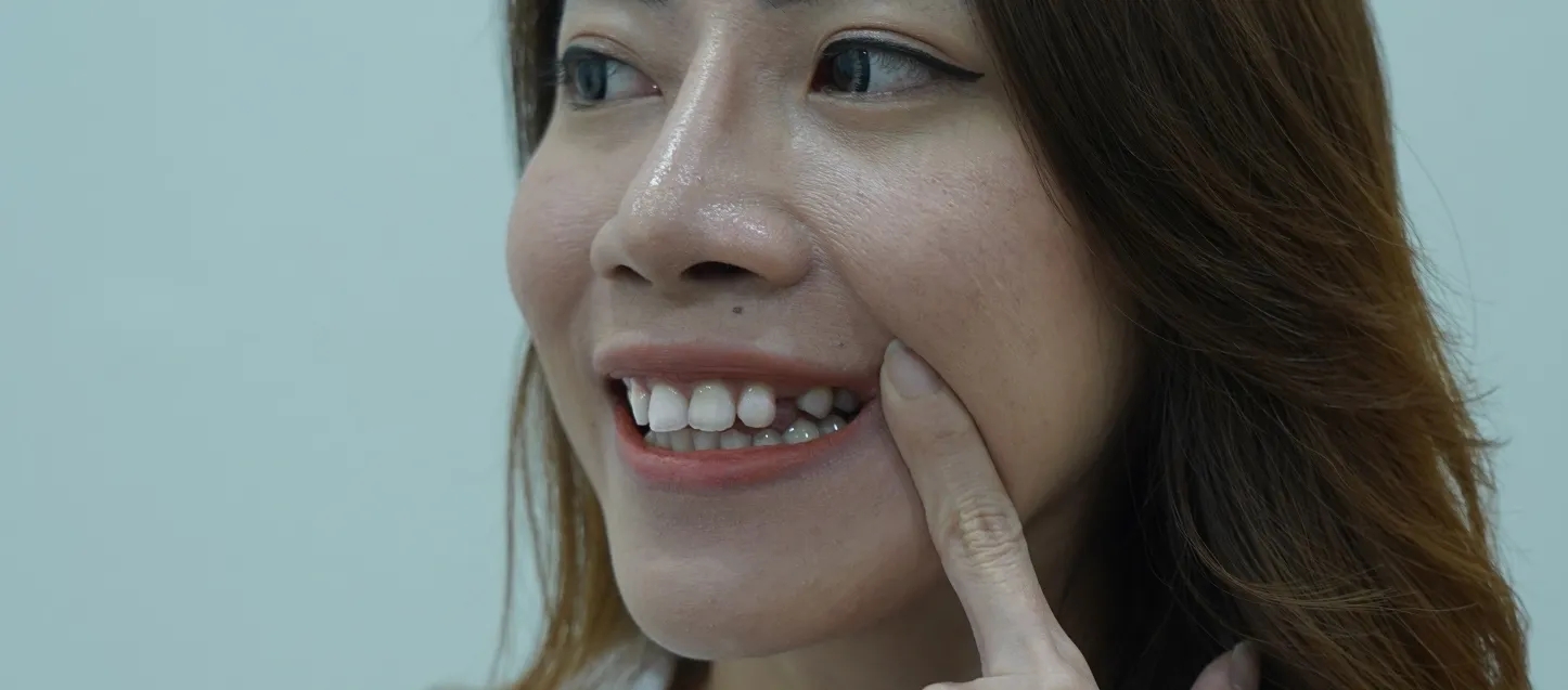 Treatment-3